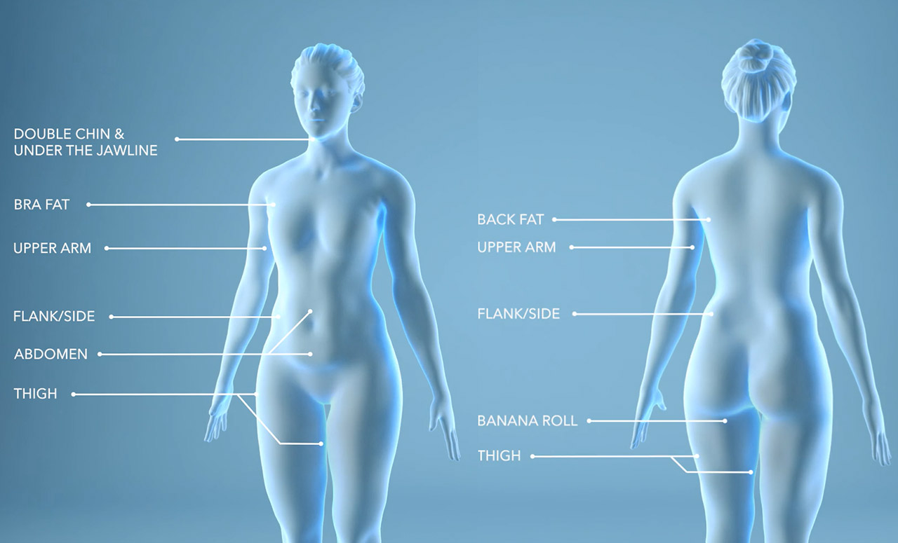 Different areas for fat reduction treatment