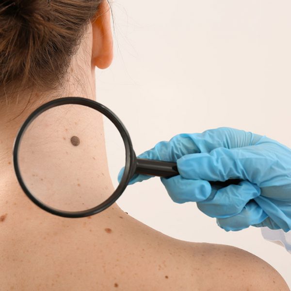 Tattoo Removal Singapore - Arium Clinic | Medical Aesthetics