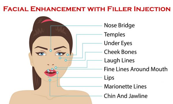 Filler Injection Singapore - Arium Clinic | Medical Aesthetics