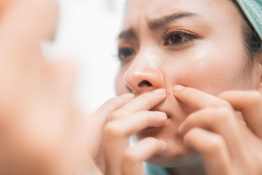 What is Pimple Injection?