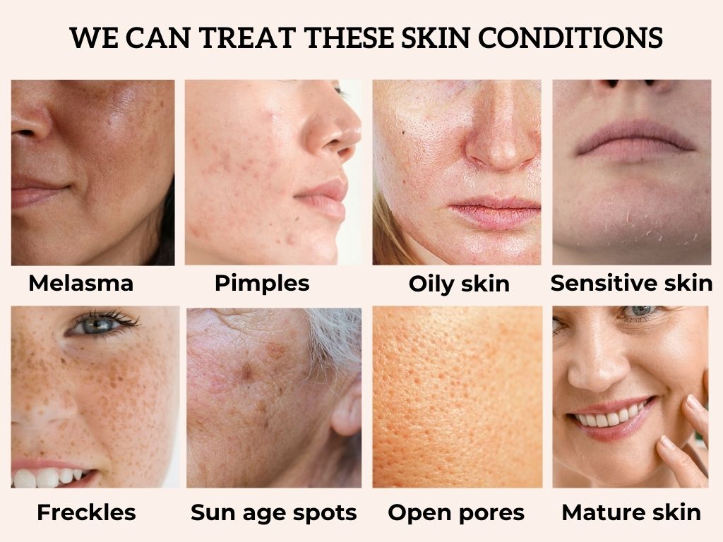 Are you looking to clear and brighter skin? - Arium Clinic